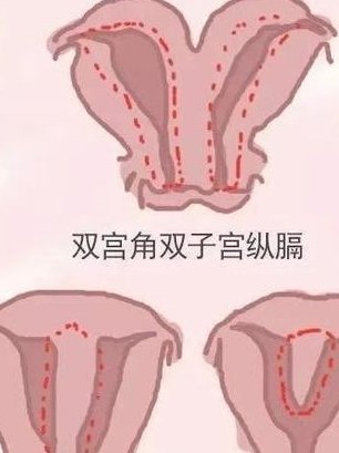 60s弄清抑郁症做试管孩子心理有无影响，这些后果要了解